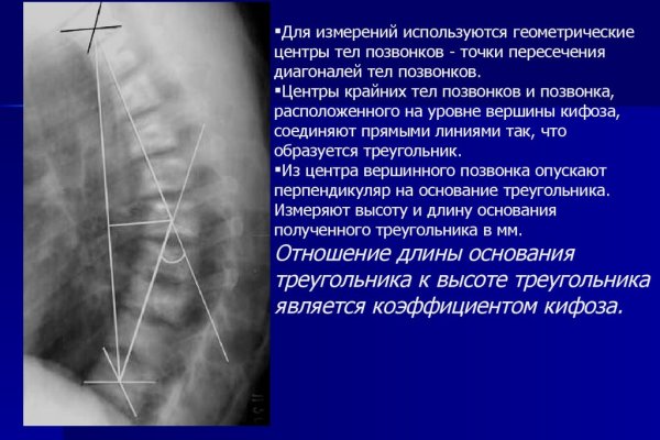 Кракен купить в москве порошок